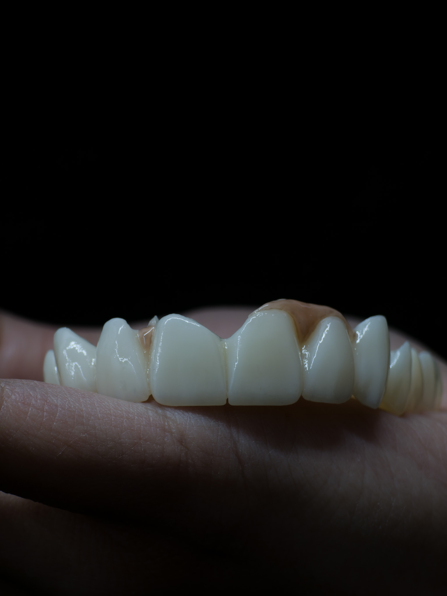 Zirconia
