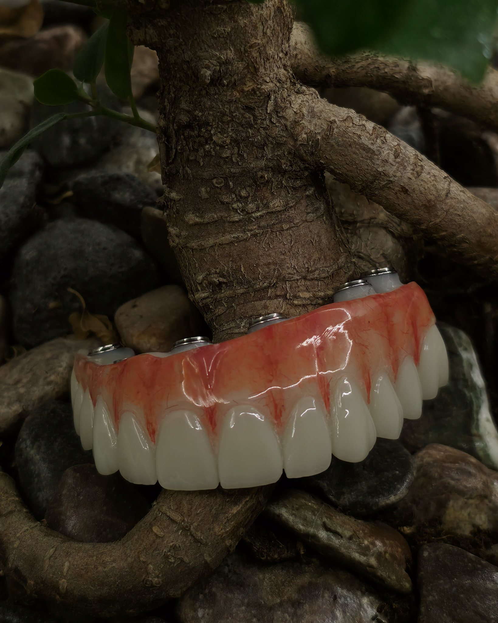 All-on-X Zirconia Case